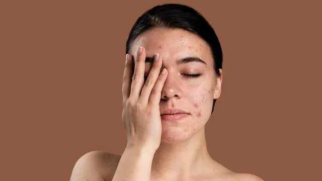 Bỏ túi ngay 3 sản phẩm kem dưỡng trắng da cho da nhạy cảm tốt nhất