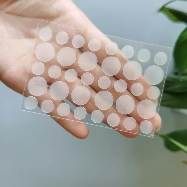 Có nên dùng miếng dán mụn hay không? Lợi ích nó mang lại là gì?