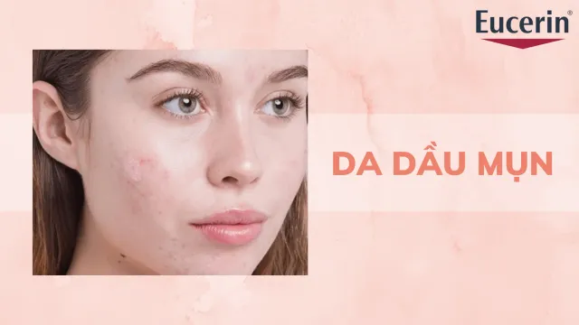 8 bước chăm sóc da dầu mụn giúp phục hồi da tại nhà
