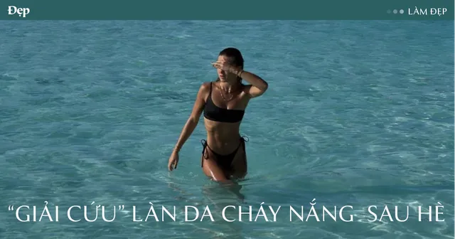 Cách trị da cháy nắng tại nhà an toàn và hiệu quả