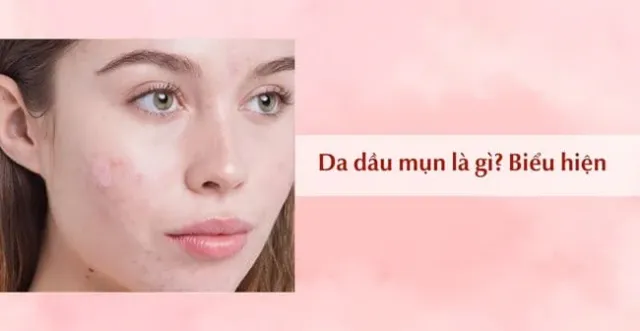 skincare-cho-da-dau-mun-1