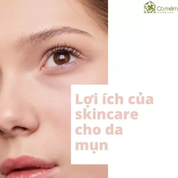 Hướng dẫn các bước skincare cho da mụn ngày và đêm chuẩn nhất