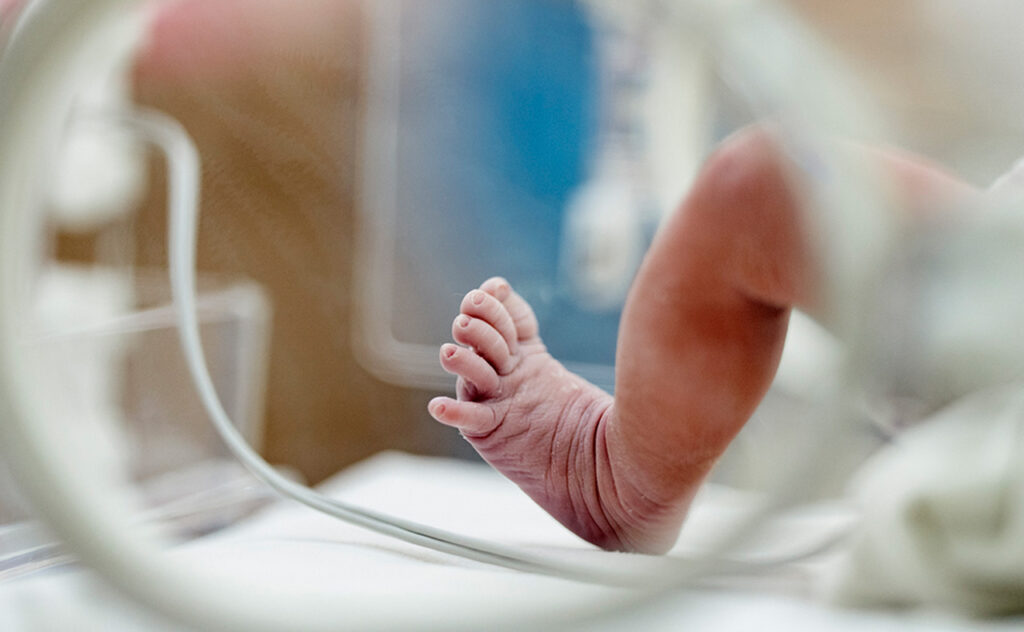 Thành phần retinoid cần tránh