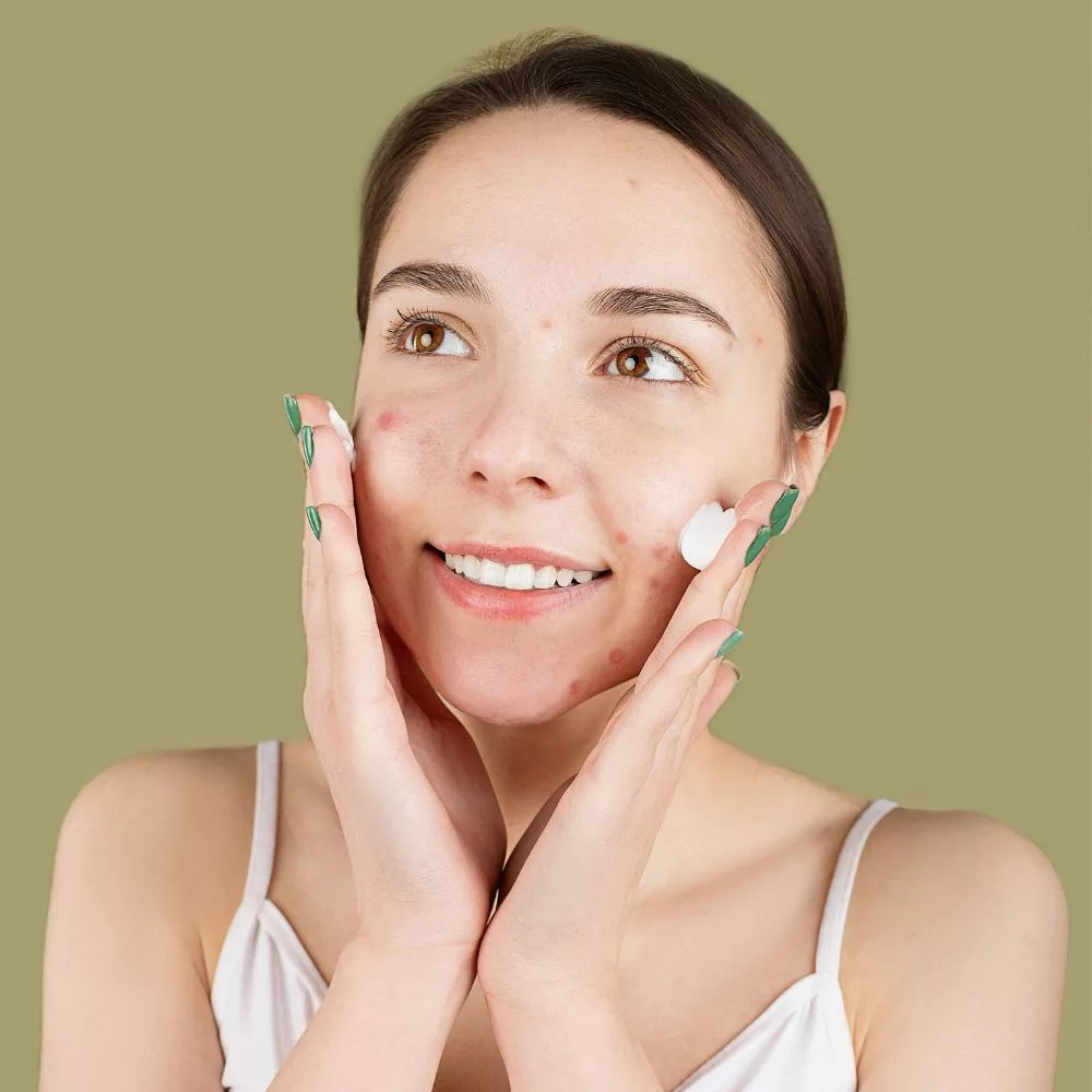 Quy trình sau khi nặn mụn