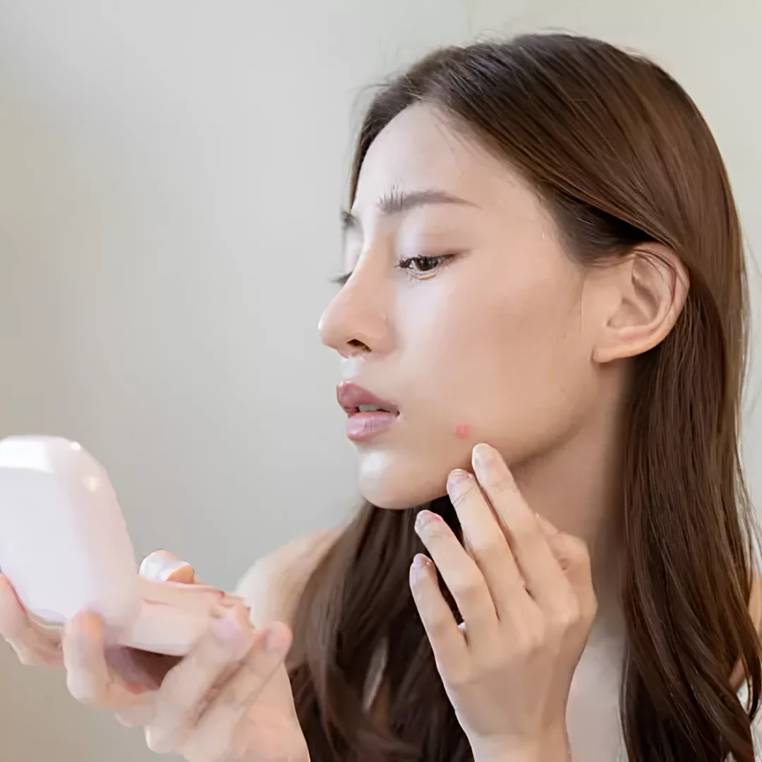 Uống thuốc theo chỉ định của bác sĩ để giảm mụn nhọt