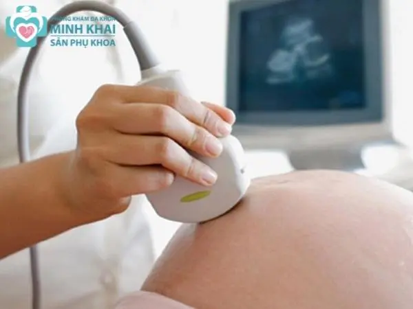 Câu hỏi về ăn uống