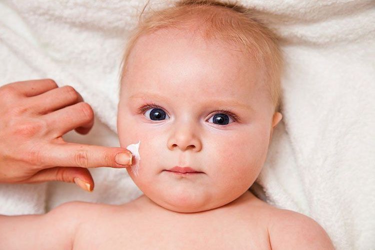 Điều trị bệnh viêm da cơ địa ở trẻ nhỏ | Vinmec
