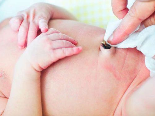 Chăm sóc rốn cho bé