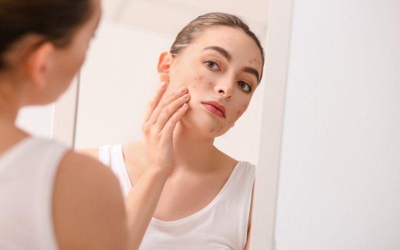 Các vấn đề da phụ nữ sau sinh