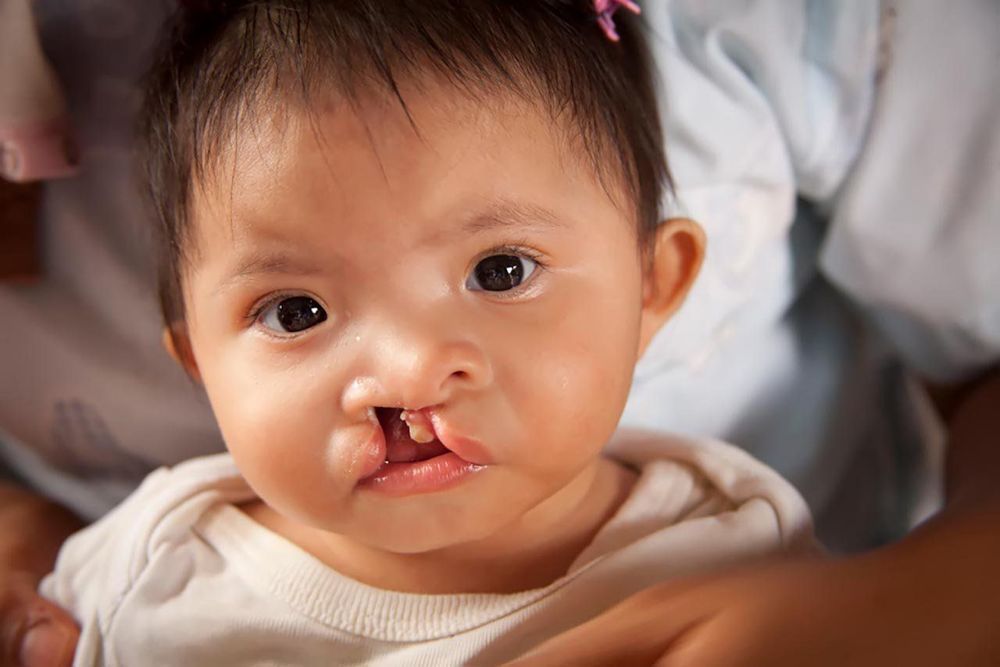 Mẹ bị nhiễm độc chì tăng nguy cơ sinh con dị dạng