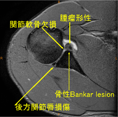 Alt lỗi dùng từ trong câu