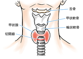 Mặt nạ bột sắn dây kết hợp lòng trắng trứng