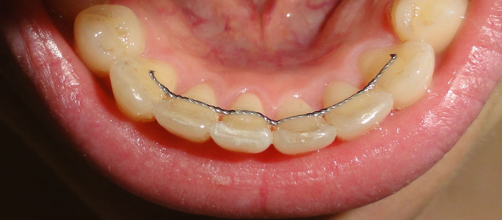Tủ đồ tối giản bền vững