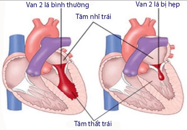 Phối tím với vàng