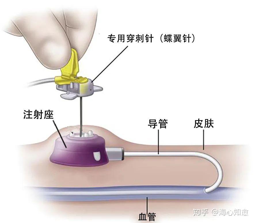 Giới từ chỉ thời gian trong tiếng Anh