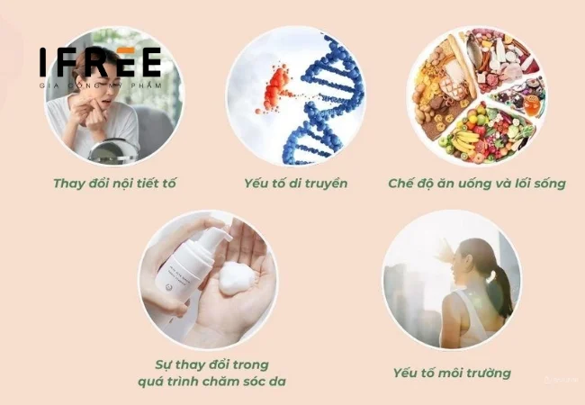 Hình minh họa da dầu mụn tuổi dậy thì
