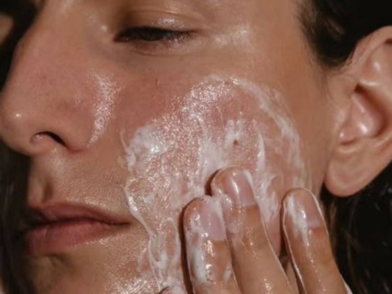 Chăm sóc da mụn là cả một quá trình cần phải tuân thủ nghiêm ngặt và thường xuyên