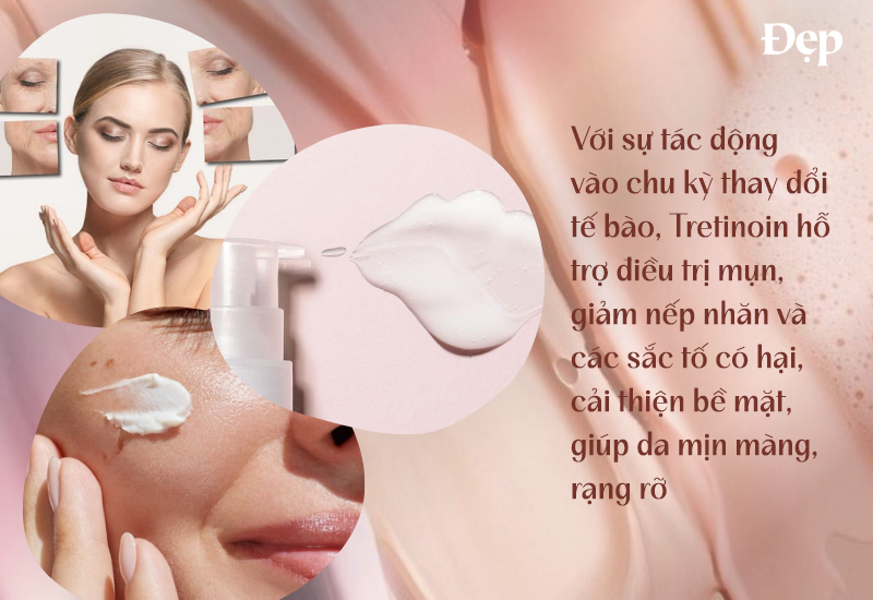 Tretinoin hỗ trợ điều trị mụn, giảm nếp nhăn và sắc tố có hại