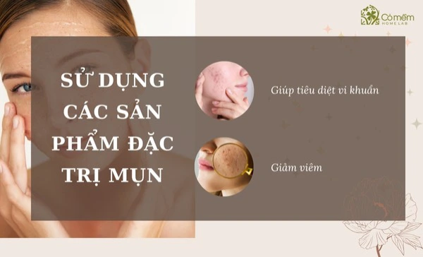 Sản phẩm đặc trị mụn