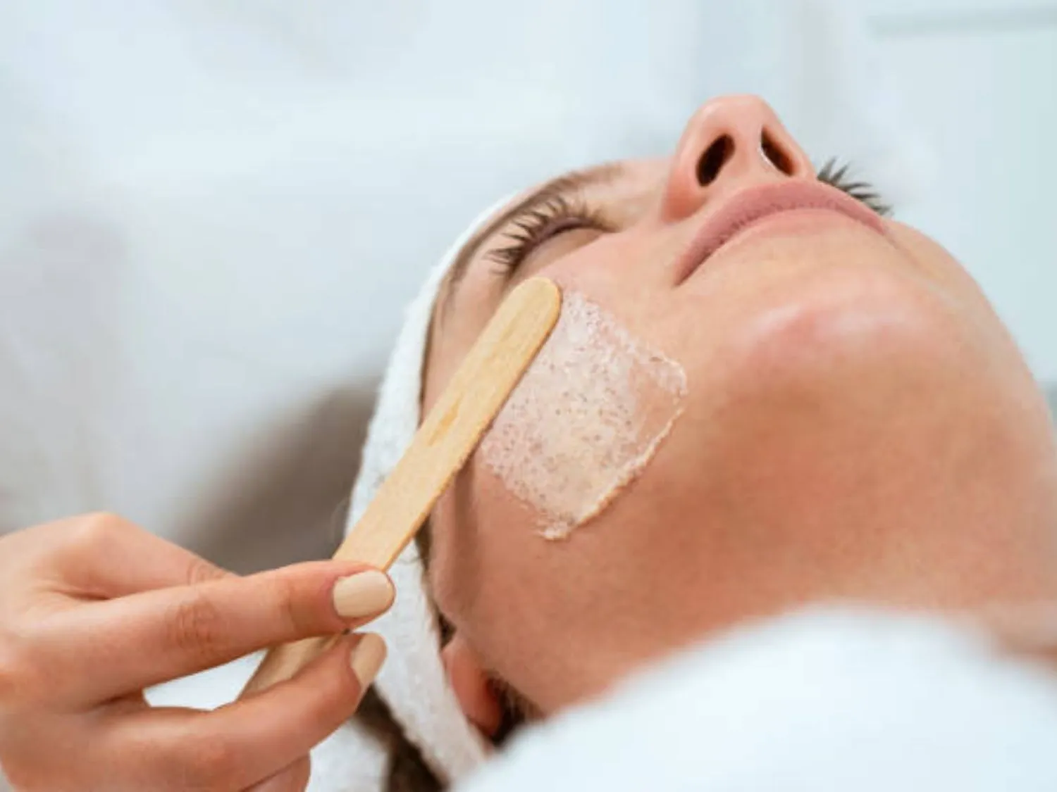 Peel da có thể được cân nhắc trong một số phác đồ điều trị mụn ẩn, nhưng cần chỉ định phù hợp