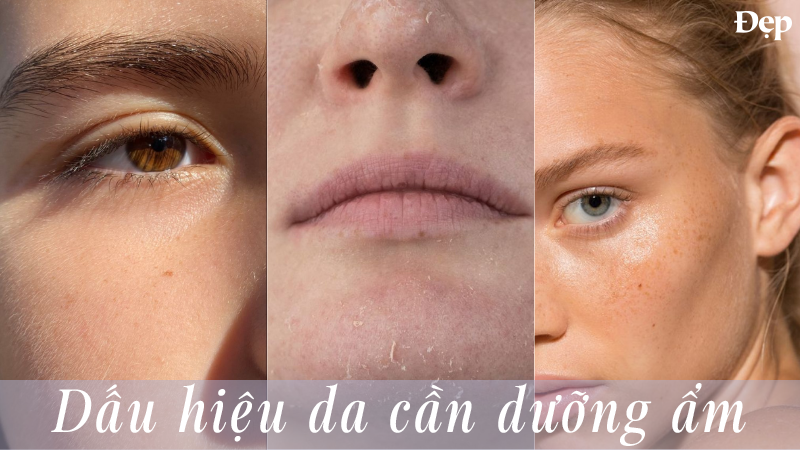 Các dấu hiệu da cần được dưỡng ẩm