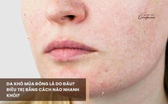 Da khô và bong tróc mùa đông