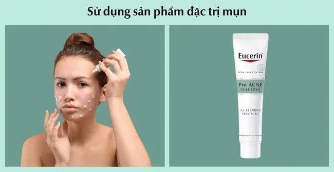 Sử dụng sản phẩm đặc trị mụn
