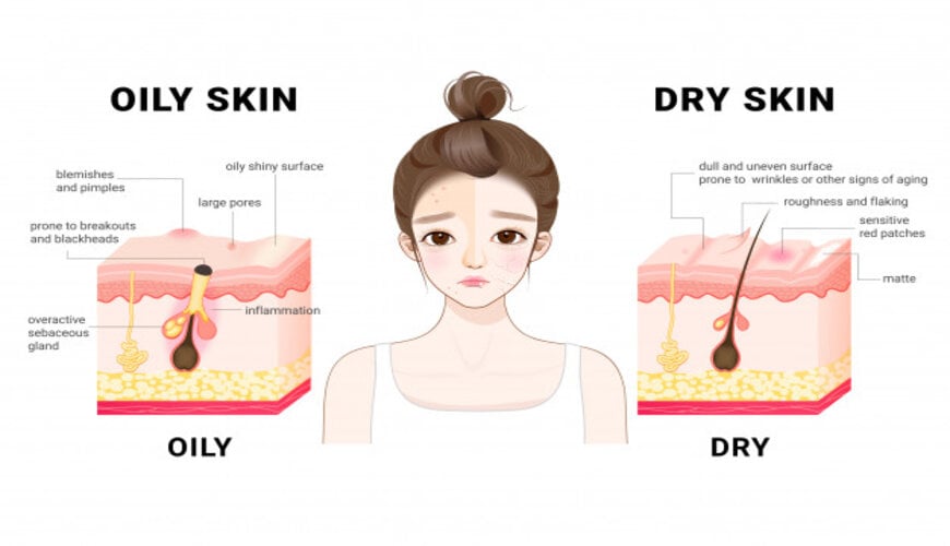 Đặc điểm của da dầu