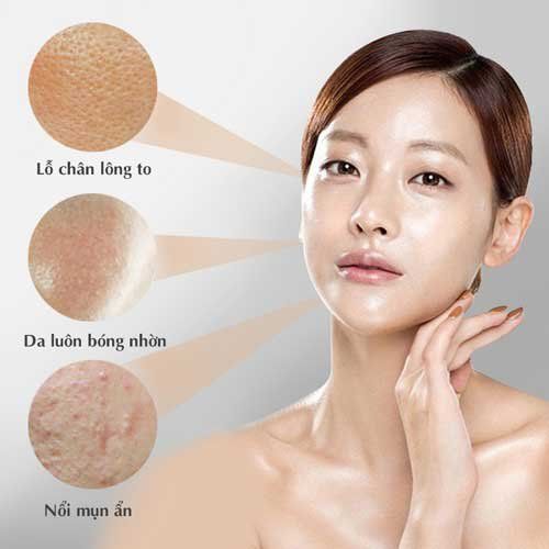 Làn da dầu bóng nhẹ ở vùng chữ T