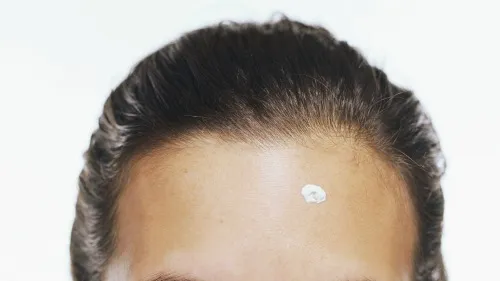 Sai lầm thường gặp khi trị mụn