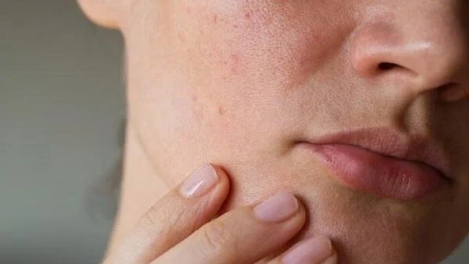 Da sạm màu, thiếu sức sống, thử ngay 4 cách chăm sóc đơn giản này