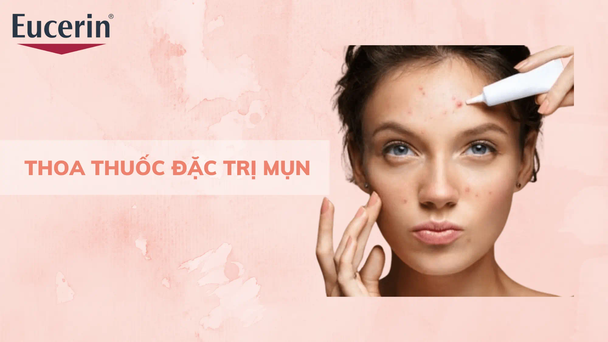 Sản phẩm đặc trị giúp xử lý nhân mụn, viêm mụn và hỗ trợ giảm tái phát