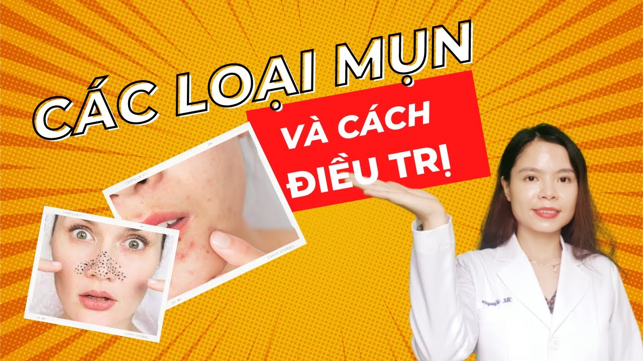 Các loại mụn và cơ chế hình thành