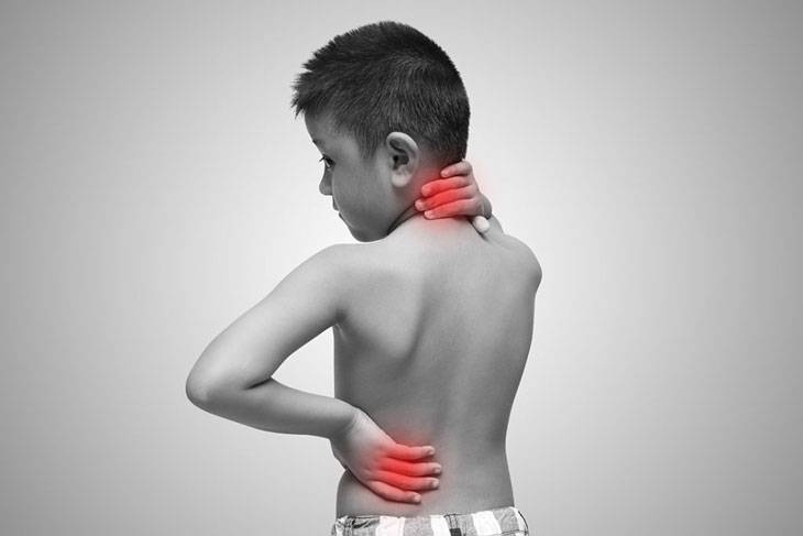 Trẻ có biểu hiện cứng cổ và lưng cần được khám sớm