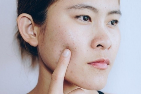 Các giai đoạn quá trình lành vết thương của da