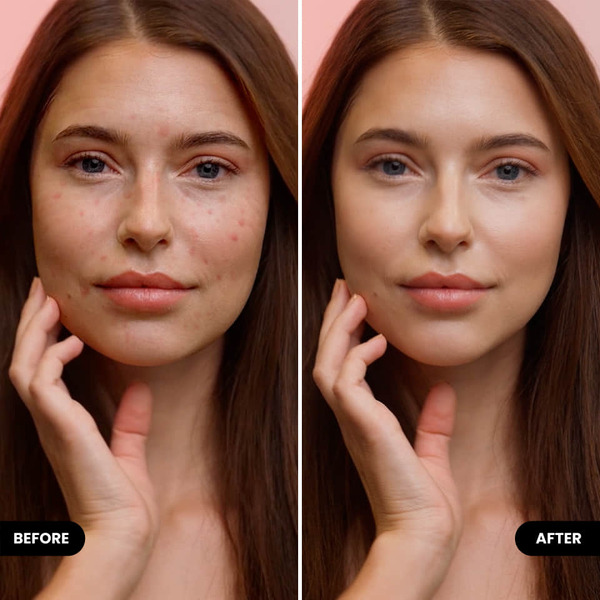 Ví dụ kết quả chỉnh mặt bằng BeautyPlus trên ảnh điện thoại
