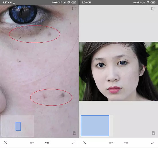 Xóa mụn bằng snapseed trên điện thoại thật dễ dàng