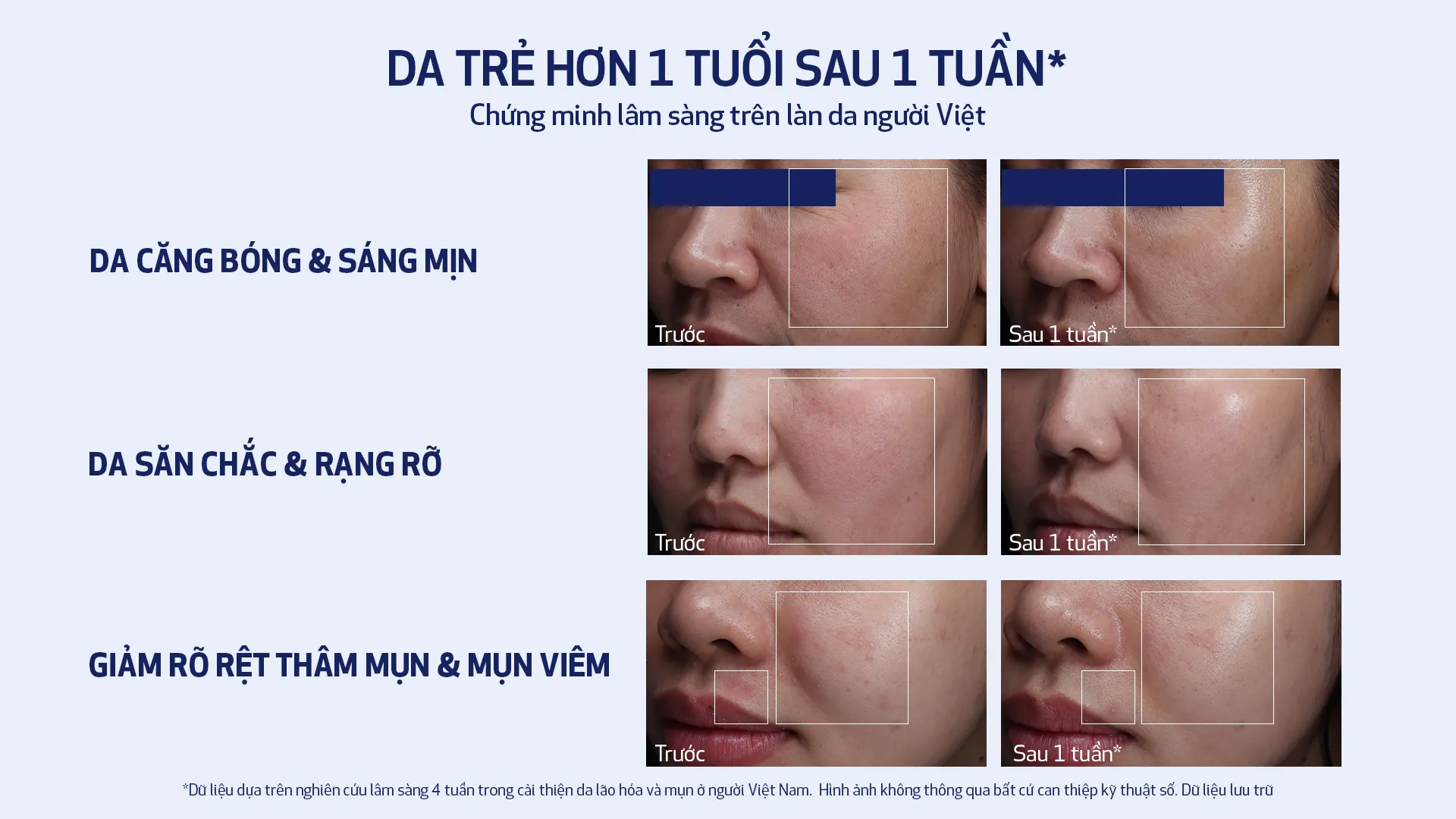 Kết quả nghiên cứu lâm sàn sản phẩm trẻ hóa da Obagi trên bệnh nhân người Việt - nguồn từ ELLE Vietnam